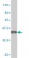 DCAMKL1 Antibody (monoclonal) (M03)